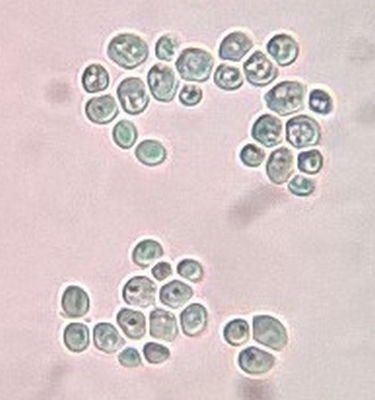 Des levures observées au microscope au grossissement  X640. Ce sont les micro-organismes qui permettent la fermentation, c'est-à-dire la transformation du sucre en alcool et en dioxyde de carbone.